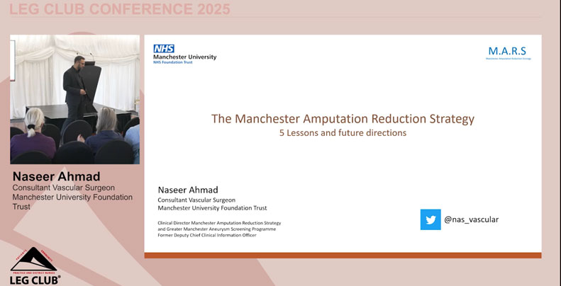 Mr Naseer Ahmad – Reducing lower limb amputations by prioritising and implementing system change for lower limb wound care