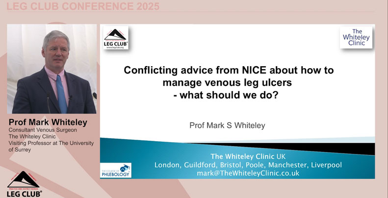 Prof Mark Whiteley – Conflicting advice from NICE about how to manage venous leg ulcers – what should we do?